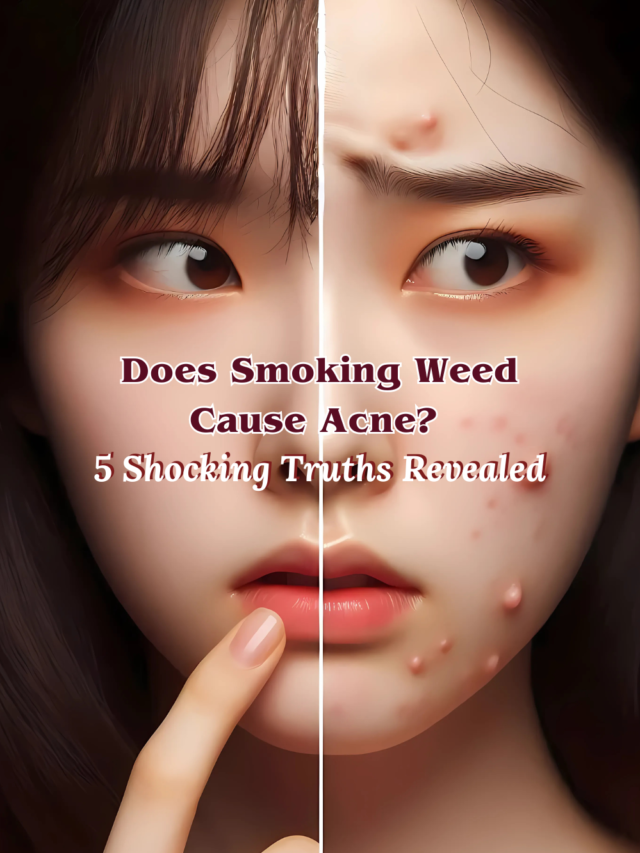Does Smoking Weed Cause Acne? 5 Shocking Truths Revealed