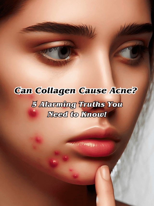 Can Collagen Cause Acne? 5 Alarming Truths You Need to Know!